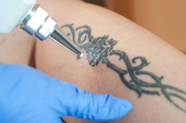 A simple, understated image of tattoo scabbing